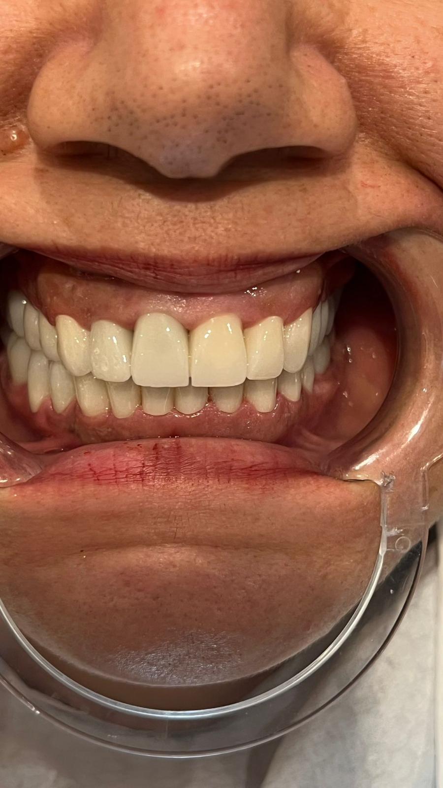 ECE Dental Patient Transformation